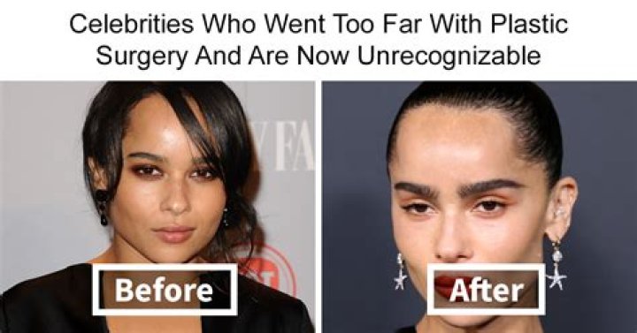 Mikhaila Peterson Plastic Surgery Before And After Photos - SarkariResult